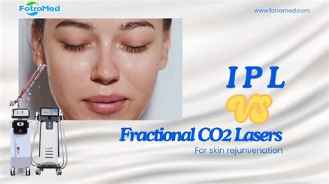 How Do Fractional CO2 Lasers Compare to IPL for Skin Rejuvenation Treatments? - Fotromed