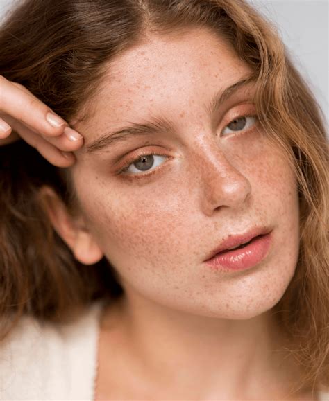 Best Pigmentation Treatment Clinic in Delhi - Derma Arts