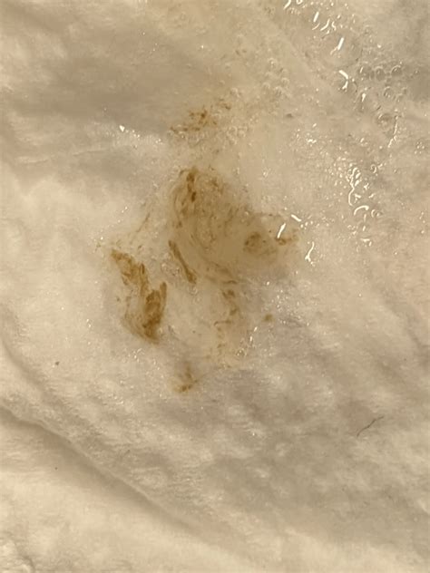 Coughing up brown flecks in phlegm. Recent flu. Doctor visit? : r ...