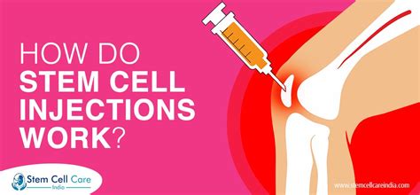 Cell Injection 的图像结果