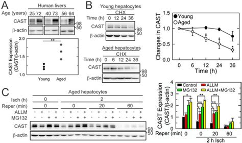 Critical Roles of Calpastatin in Ischemia/Reperfusion Injury in Aged Livers