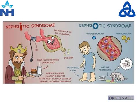 Nephritic vs nephrotic syndrome6npoqoa8qakc (1).pdf