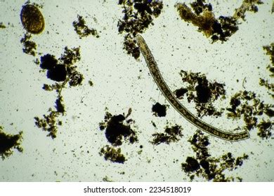 Scalp Parasites 的图像结果