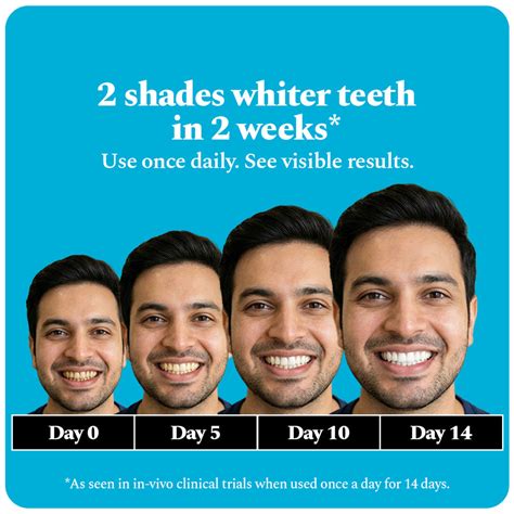 Teeth Whitening: Get Brighter Teeth At Home! – Perfora - Oral Care ...