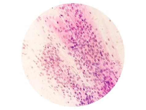 Trichomonas vaginalis dans un frottis vaginal avec peu de cellules ...