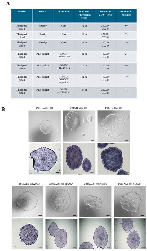 Identification of Transcriptomic Differences in Induced Pluripotent ...