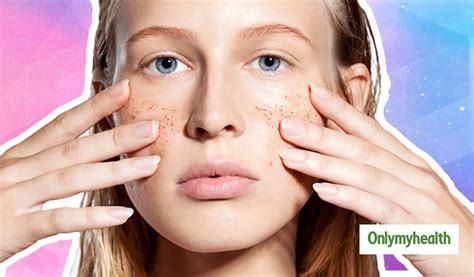 Don't Use Scrub In These 4 Skin conditions In Hindi | do not use scrub ...