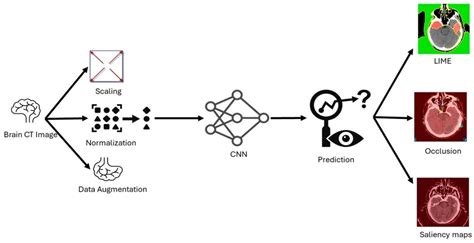 Stroke Detection in Brain CT Images Using Convolutional Neural Networks ...