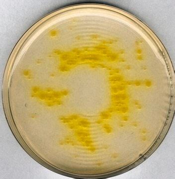 Óleo de imersão for microscopy | Sigma-Aldrich