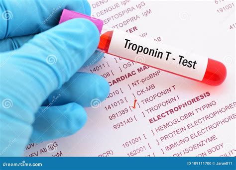 Troponin T test stock photo. Image of cardiovascular - 109111700