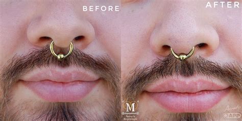 Can You Repierce The Same Spot