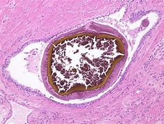 Image result for amylaceum