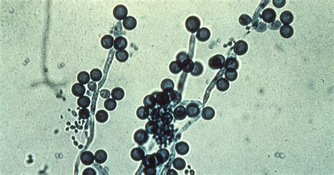 Kuvatulokset haulle candida
