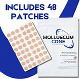 Buy Molluscum Gone Hydrogel Patches - Treatment for Molluscum ...