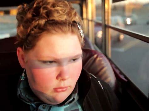 Obesity in children and teens | Meer