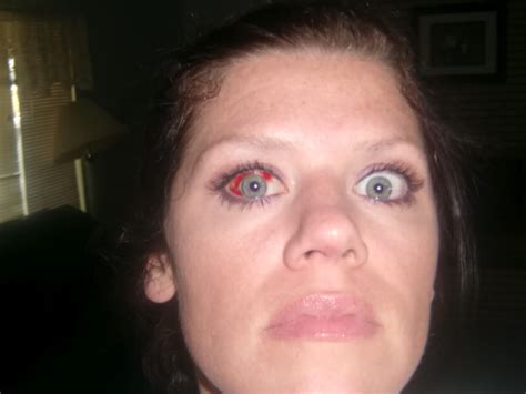 Throwing Up Blood Vessels Pregnancy at Victor Adkins blog