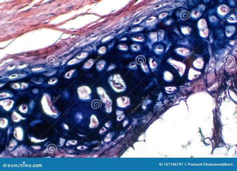 Human Hyaline Cartilage Bone Under Microscope View for Education ...