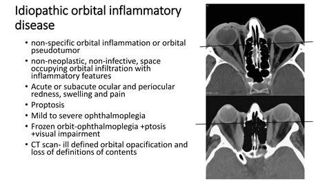 anatomy of orbital spaces, tumours and its importance | PDF