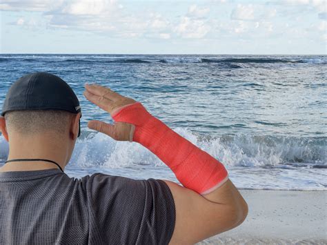 Broken Wrist?Need a waterproof cast? - Castle Hill Hand Therapy