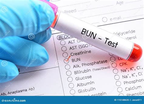 Blood Test Elevated Bun at Phyllis Gordon blog