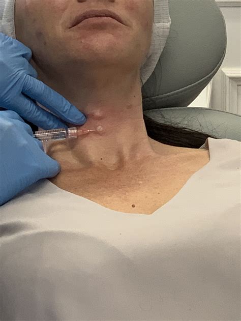 Image result for Tutorial Prophilo