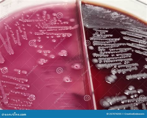 E Coli On Blood Agar