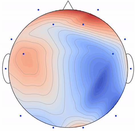 Advancements in EEG Emotion Recognition: Leveraging Multi-Modal ...
