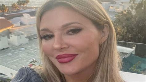 Bachelor Star Brandi Glanville Health Update: What Happened To Her Face ...