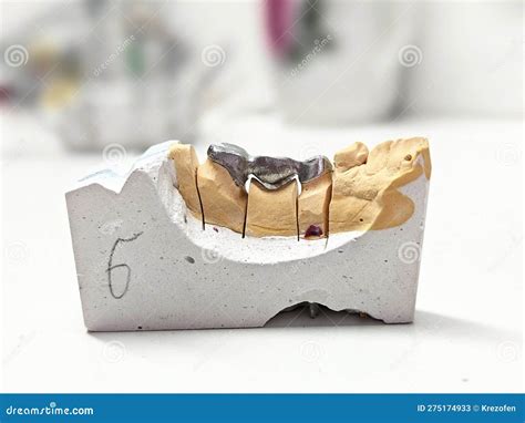 Metal Caps for the Manufacture of Dental Ceramic-metal Dental Bridges Stock Image - Image of ...