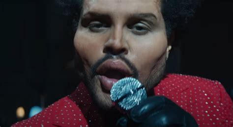 Watch The Weeknd Play A Plastic-Surgery Disaster In His Bizarre “Save ...