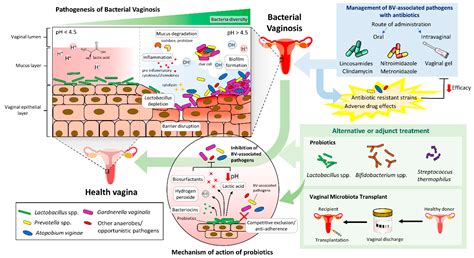 Bacterial Vaginosis In Men