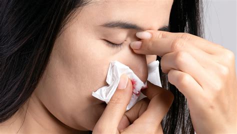 Nose Bleeding Causes While Sleeping