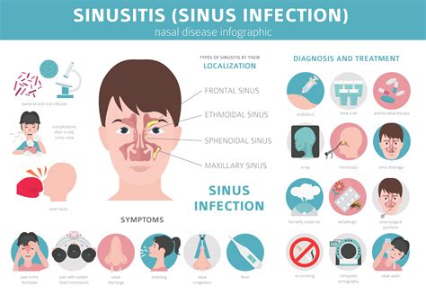 Sinusitis with cough treatment