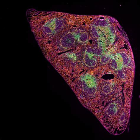 ZEISS supports the transition of spatial biology to clinical research