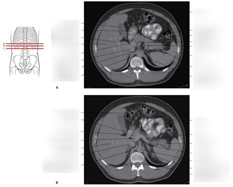 CT Scan 的图像结果