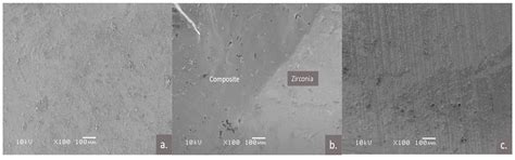 Shear Bond Strength of Veneered Zirconia Repaired Using Various Methods ...