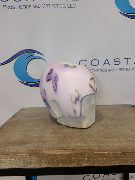 Cranial Remolding Helmets- A Solution for Positional Plagiocephaly and Brachycephaly in Infants ...