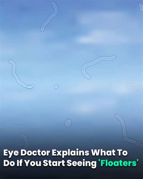 What Are Eye Floaters? Here What To Do If you Start Seeing Them, According to an Eye Doctor ...