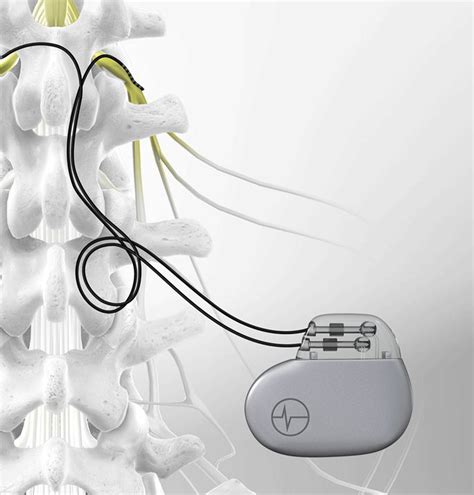 What Is Back Stimulator at Max Ogilvie blog