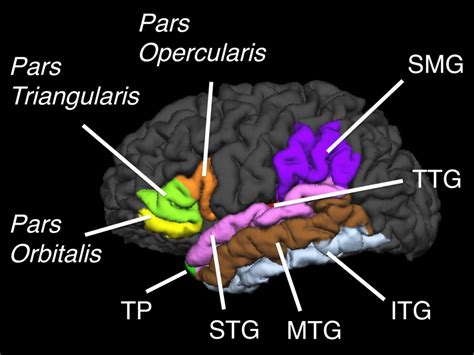 Altered brain structures in the dorsal and ventral language pathways in ...