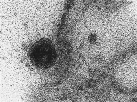 Scientist Capture Exact Moment Coronavirus Infects Cell On Powerful ...