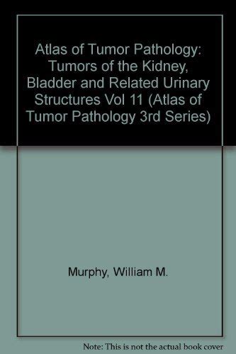 Buy Tumors of the Kidney, Bladder and Related Urinary Structures (Vol ...