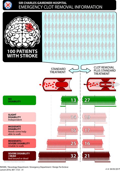 Acute Large Vessel Occlusion (LVO) Stroke: Emergency Clot Removal ...