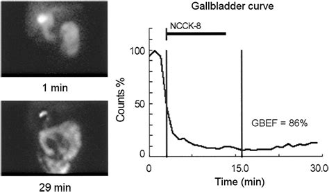 Hepatobiliary Imaging | Journal of Nuclear Medicine Technology