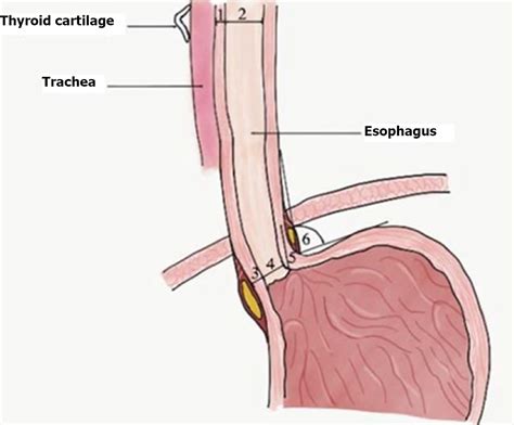 Gastroesophageal reflux disease in children: What’s new right now?