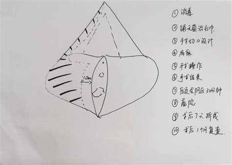 Detailed introduction to the whole process of private labia minora surgery - iMedia