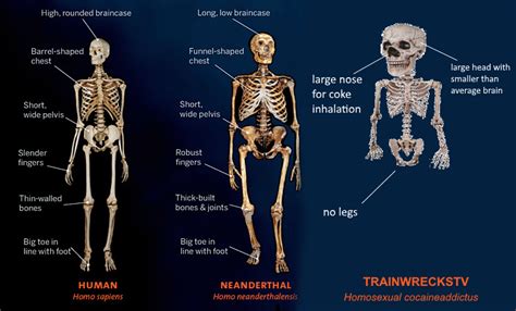 Image result for Skeleton Brain Exploding