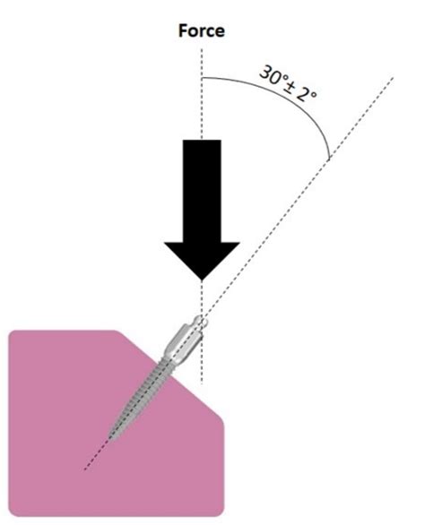Does the Length of Mini Dental Implants Affect Their Resistance to ...