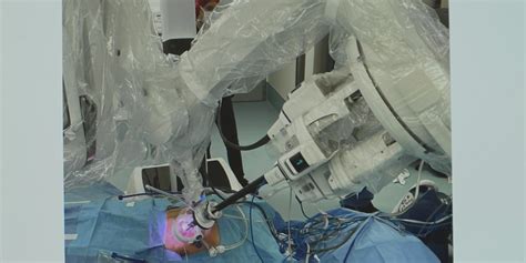 YOUR HEALTH: Adrenal robotic surgery is game changer