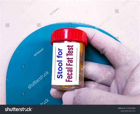 Image result for Feces Sample